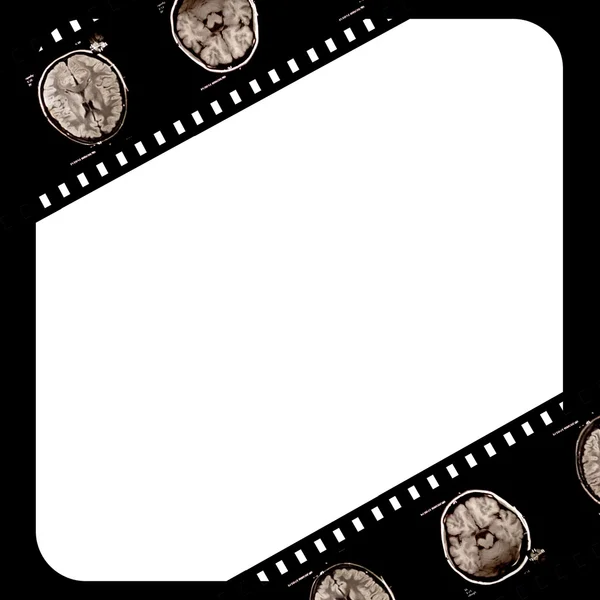 Film on grunge background — Stock Photo, Image