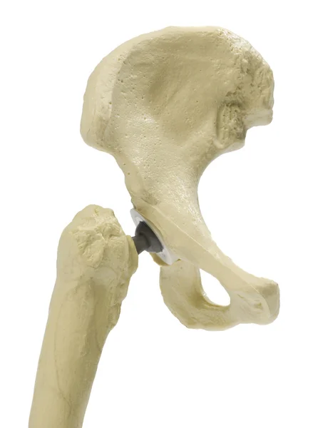 Plastic model of a hip — Stock Photo, Image