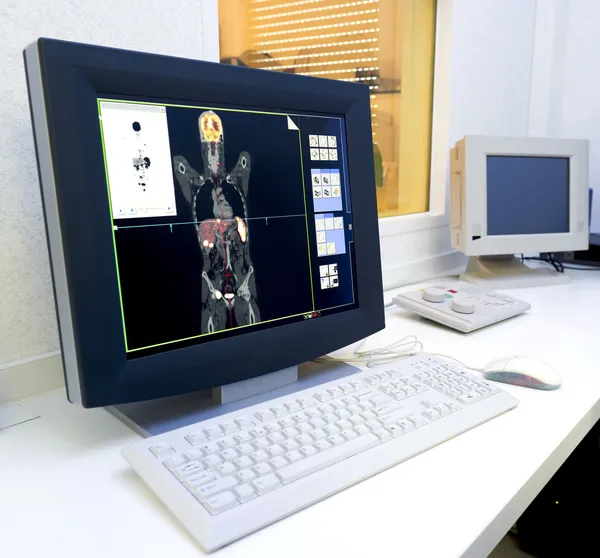 Monitore com uma imagem feita com o PET / IC scan — Fotografia de Stock