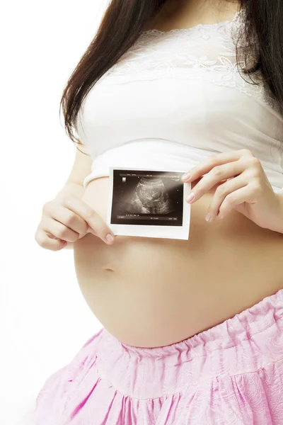 Mujer embarazada con una fotografía de ultrasonido . — Foto de Stock
