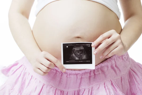 Mujer embarazada con una fotografía de ultrasonido . — Foto de Stock
