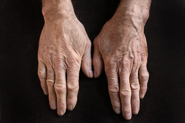 Mãos velhas — Fotografia de Stock