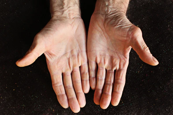Stare pomarszczone dłonie — Zdjęcie stockowe