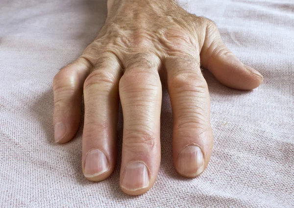 Старим зморшкуватою рукою — стокове фото