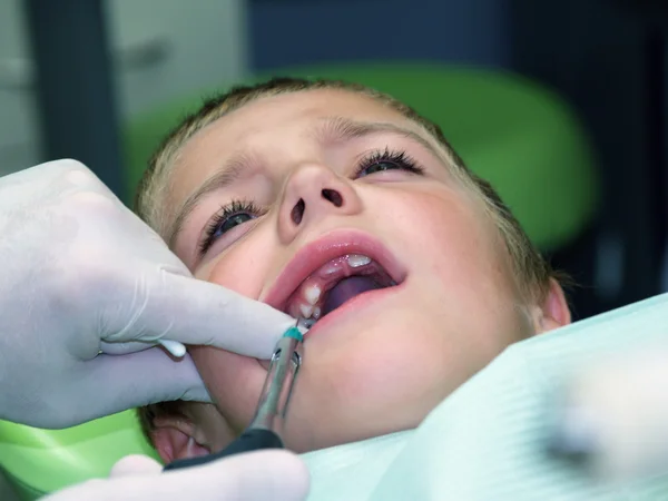 Menino em tratamento dentário — Fotografia de Stock