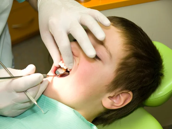 歯科治療 — ストック写真