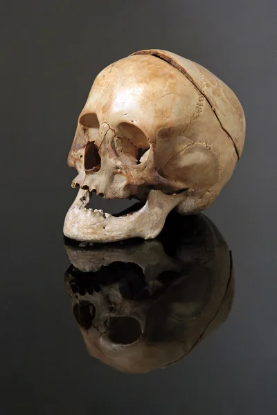 Real skull — Stock Photo, Image