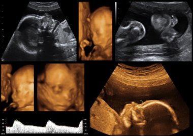 Ultrasonographic Photos from a Baby clipart