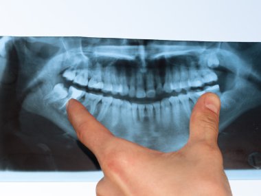 Dental X-Ray panoramic clipart