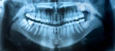 Dental X-Ray panoramic clipart