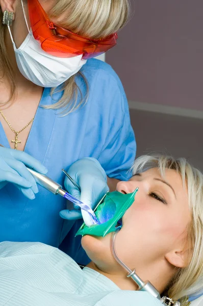 Dentistry, tooth cavity stopping — Stock Photo, Image